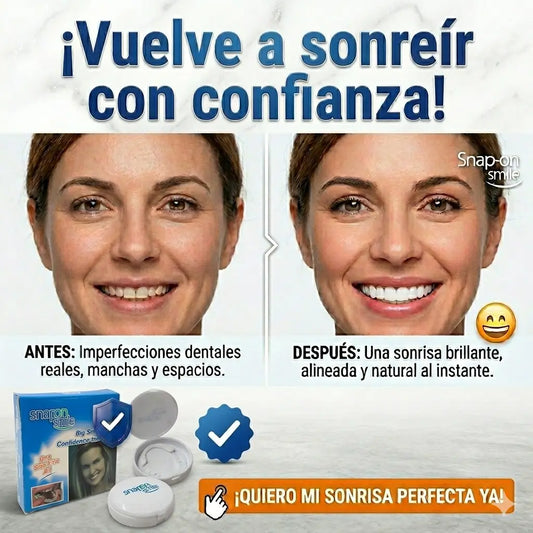 SNAPON SMILE - CARILLAS DENTALES Sonrisa al instante